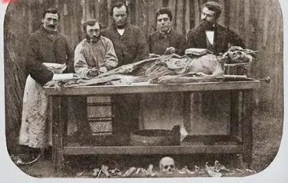 恐怖诡异，12张百年前解剖人T的照片！