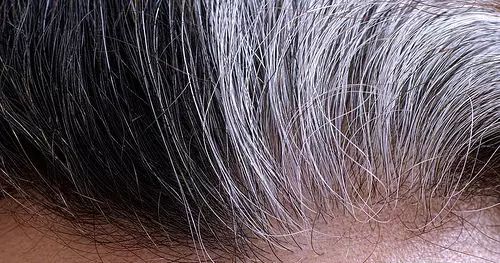 科学家不小心发现一种药物可以让你的白发变黑！