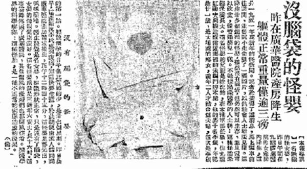 恐怖热线：公园草丛发现灰肤大头怪婴，大头、无生Z器官，吓坏踢球学生