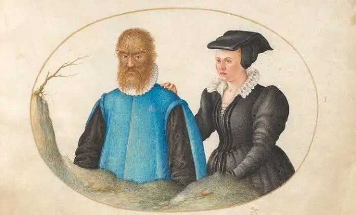 7个比电影还离奇的历史奇人: 用秘密语言沟通的“沉默双胞胎”在这一天开口了