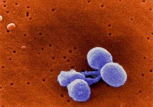 组图：盘点世界上最致命的七大病菌
