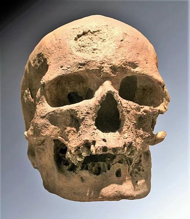 法国重塑2.8万年前远祖智人克鲁马努一号面貌，重建后满脸纤维瘤