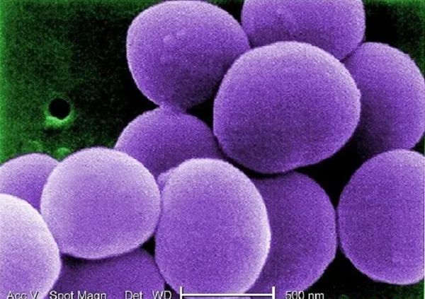 组图：盘点世界上最致命的七大病菌